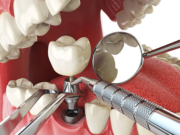Best Emergency Broken Tooth Repair in West Pasco, WA